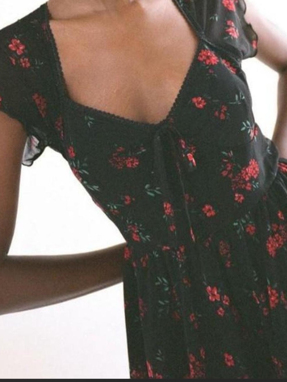 UO Romper